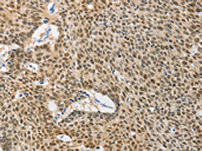 DNAJB1 Antibody