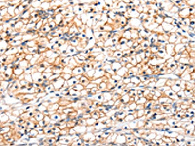 GLP1R Antibody