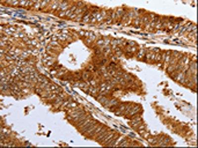 DNMT1 Antibody