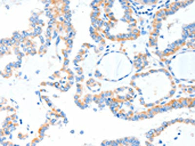 TLR2 Antibody
