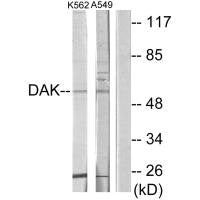 DAK Antibody