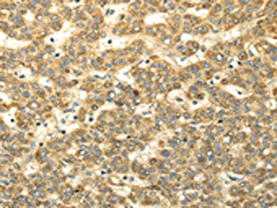 WDR91 Antibody