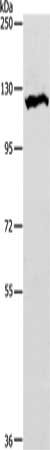 NOTCH1 Antibody