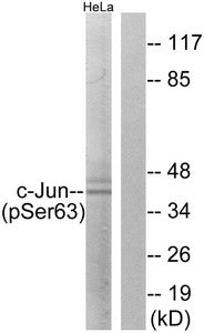 Phospho-JUN (Ser63) Antibody