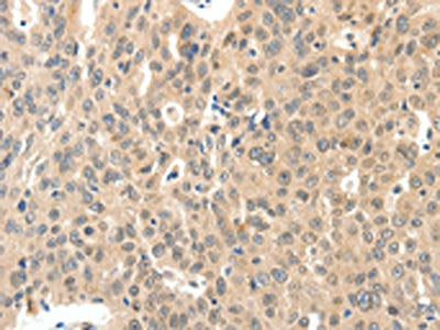 ROS1 Antibody