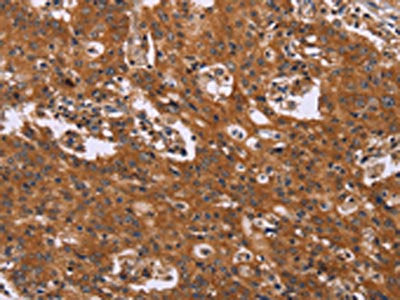 CMTM6 Antibody