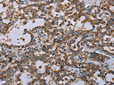 MMP23A Antibody
