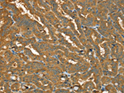 PYGL Antibody