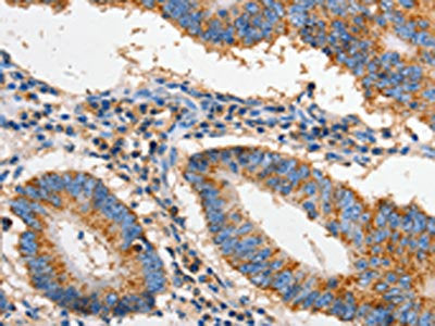 FAS Antibody