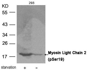 Phospho-MYL9 (Ser19) Antibody