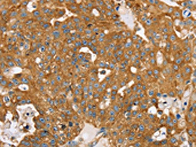 TPD52L2 Antibody
