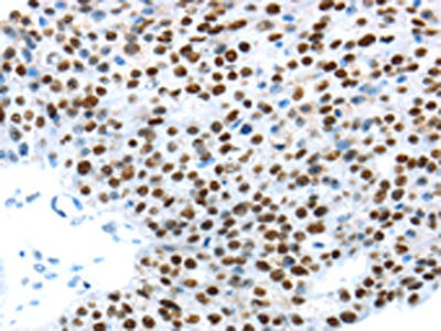 UBA1 Antibody