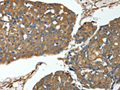 MSN Antibody