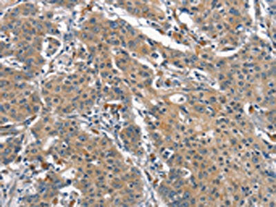 OLR1 Antibody