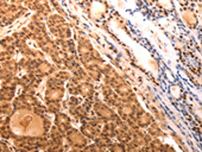 SERPINC1 Antibody