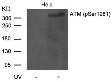 Phospho-ATM (Ser1981) Antibody