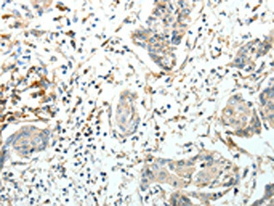 FZD3 Antibody