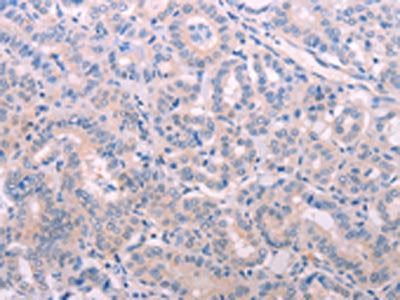 TIMP4 Antibody