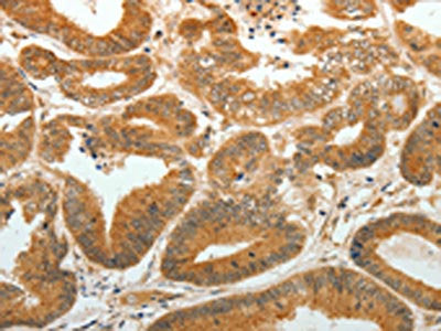 AKR1C1 Antibody