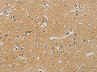 NDRG1 Antibody