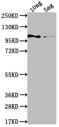 Genome polyprotein Antibody