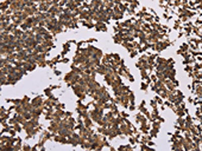 OTC Antibody