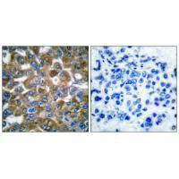 KRT15 Antibody