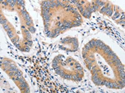 PIWIL2 Antibody