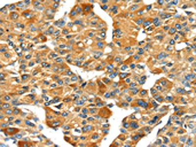 SPARC Antibody