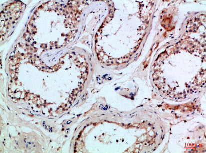 PIK3R2 Antibody
