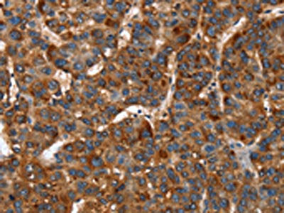 CACNB2 Antibody