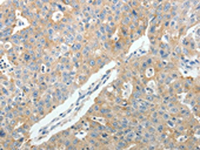 PTGDS Antibody
