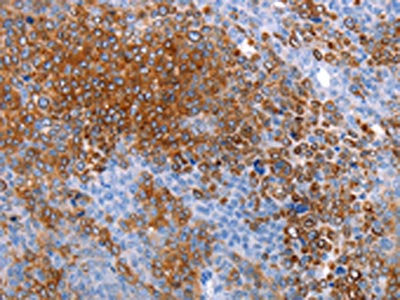 AQP5 Antibody