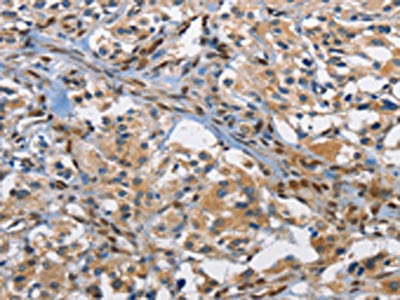 FOS Antibody