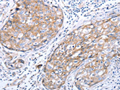 RASSF1 Antibody