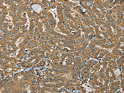 SDHB Antibody