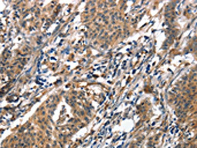 ALOX15 Antibody