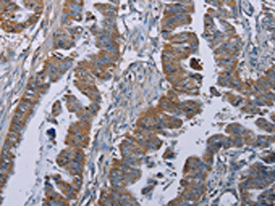 BMP3 Antibody