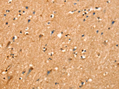 SLC26A4 Antibody