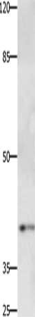 PTGER1 Antibody