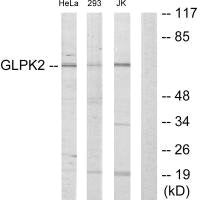 GK2 Antibody