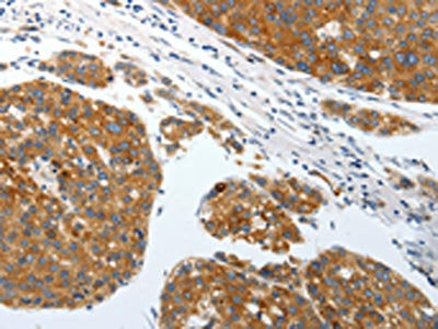 SLC22A3 Antibody
