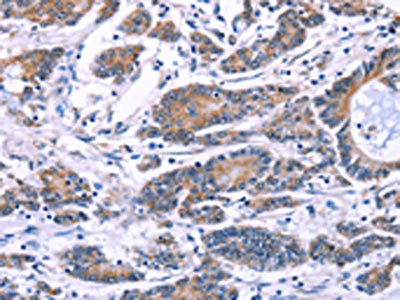 SYT4 Antibody
