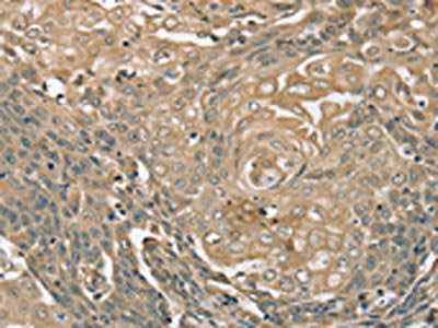 PIK3CD Antibody