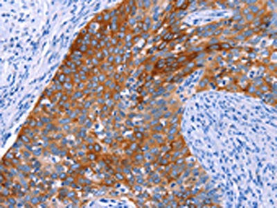 SGK2 Antibody