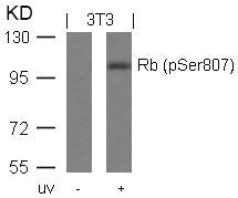 Phospho-RB1 (Ser807) Antibody