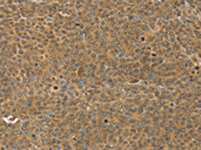 MED15 Antibody