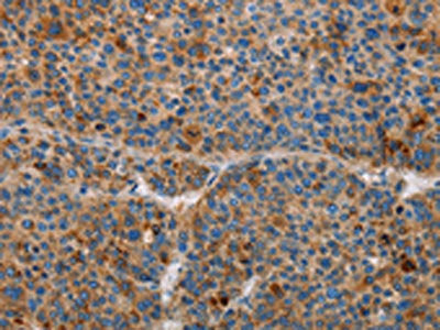 AMBP Antibody