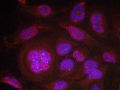 Phospho-RELA (Ser276) Antibody