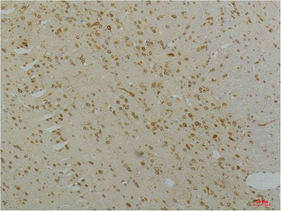 CACNA1C Antibody